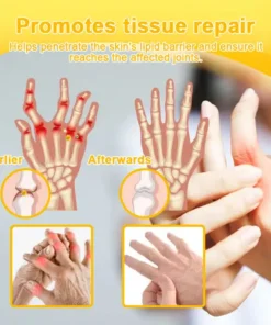 ODALIT™ Botulinum Toxin & Bee Venom Pain-Relief Bone Healing Cream
