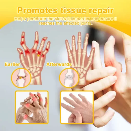 ODALIT™ Botulinum Toxin & Bee Venom Pain-Relief Bone Healing Cream