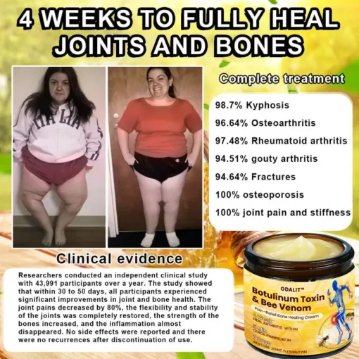 ODALIT™ Botulinum Toxin & Bee Venom Pain-Relief Bone Healing Cream