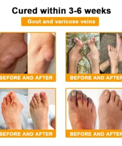 ODALIT™ Botulinum Toxin & Bee Venom Pain-Relief Bone Healing Cream