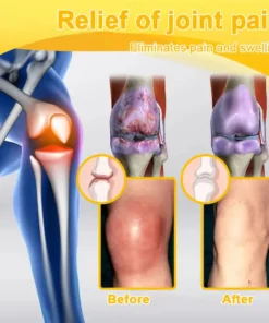 ODALIT™ Botulinum Toxin & Bee Venom Pain-Relief Bone Healing Cream