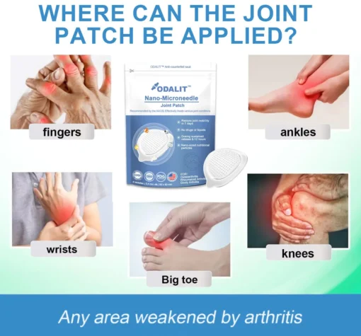 ODALIT™ Nano-microneedle joint patch