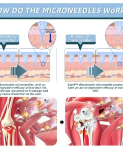 ODALIT™ Nano-microneedle joint patch