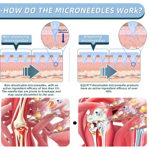 ODALIT™ Nano-microneedle joint patch
