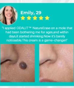 ODALIT™ Nature Erase Instant Mole & Spot Removal Gel