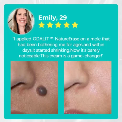 ODALIT™ Nature Erase Instant Mole & Spot Removal Gel