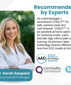 ODALIT™ Non-Invasive Mole and Wart Removal Laser Pen