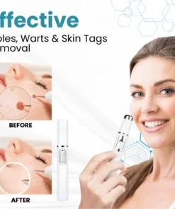 ODALIT™ Non-Invasive Mole and Wart Removal Laser Pen