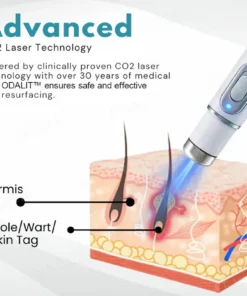 ODALIT™ Non-Invasive Mole and Wart Removal Laser Pen