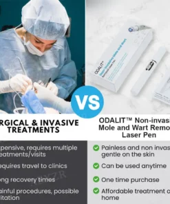 ODALIT™ Non-Invasive Mole and Wart Removal Laser Pen