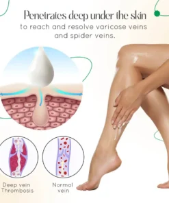 ODALIT™ Vein Therapy Cream