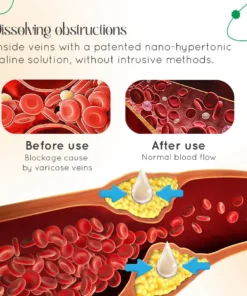 ODALIT™ Vein Therapy Cream