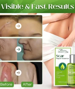 ODALIT™ Scar Repair Essence