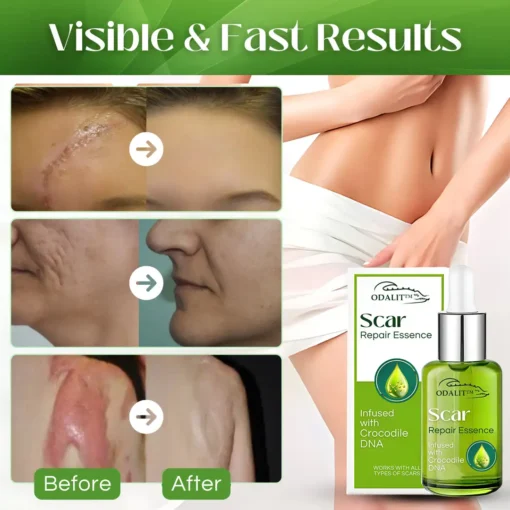 ODALIT™ Scar Repair Essence