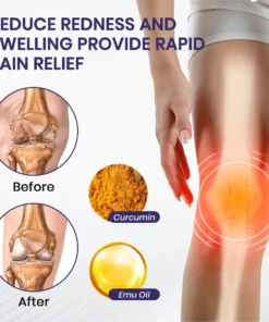 ODALIT™ Turmeric & Emu Oil Arthritis Soothing Pain Relief Massage Gel