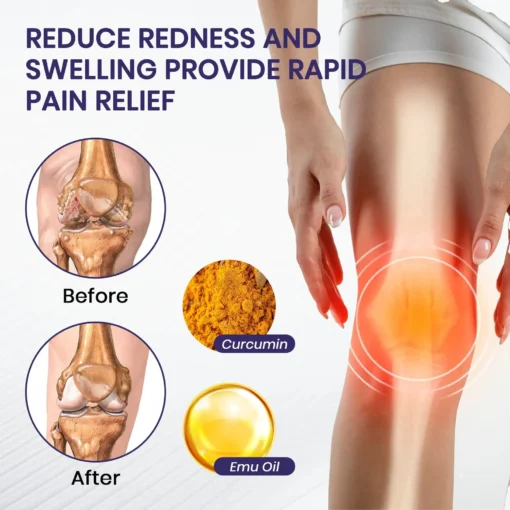 ODALIT™ Turmeric & Emu Oil Arthritis Soothing Pain Relief Massage Gel