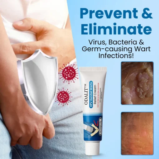ODALIT™ HPV Genital Warts Relief Cream