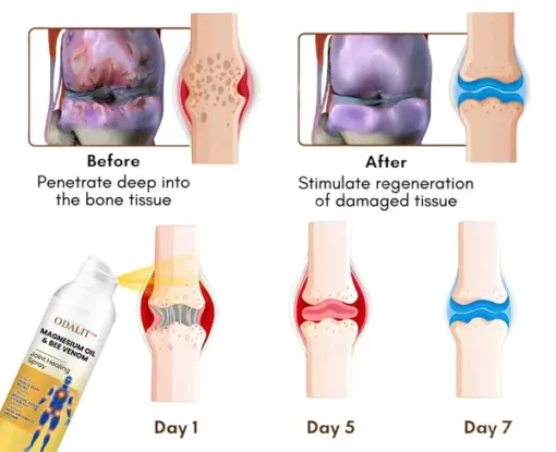ODALIT™ Magnesium Oil & Bee Venom Joint Healing Spray