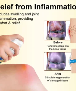 ODALIT™ Magnesium Oil & Bee Venom Joint Healing Spray