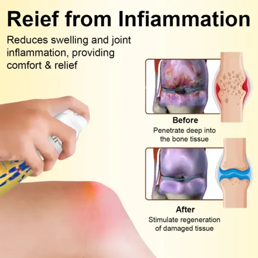 ODALIT™ Magnesium Oil & Bee Venom Joint Healing Spray