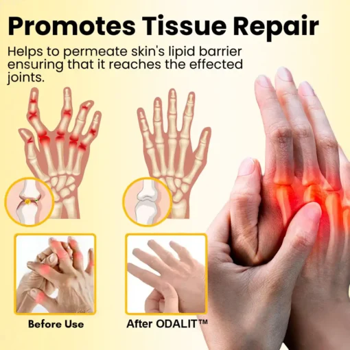 ODALIT™ Magnesium Oil & Bee Venom Joint Healing Spray
