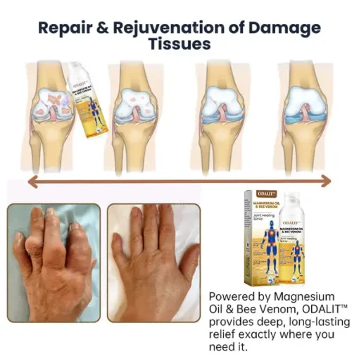 ODALIT™ Magnesium Oil & Bee Venom Joint Healing Spray