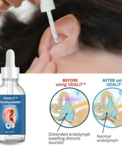ODALIT™ Tinnitus Relief Ear Drops