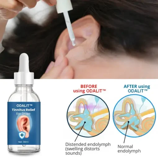 ODALIT™ Tinnitus Relief Ear Drops