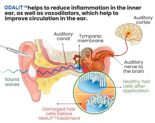 ODALIT™ Tinnitus Relief Ear Drops