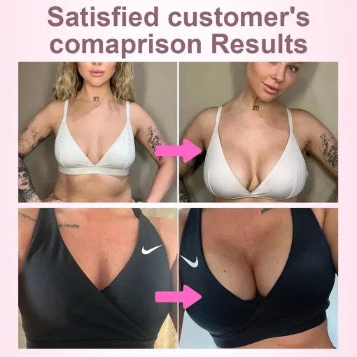 ODALIT™Breast Enhancement Nano Patch