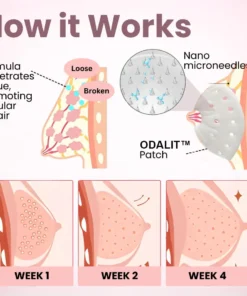 ODALIT™Breast Enhancement Nano Patch