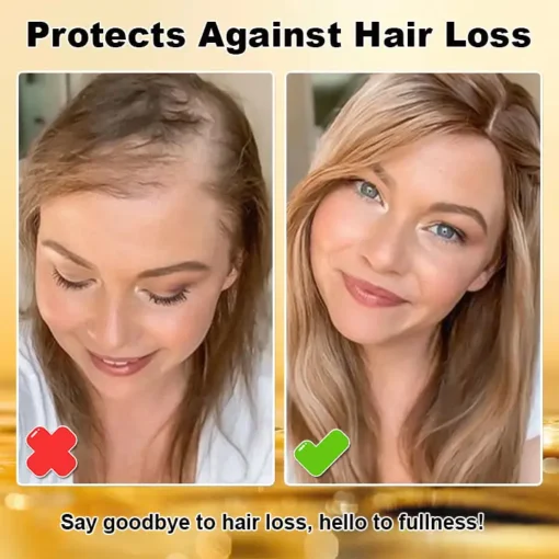 ODALIT™ Biotin Hair Growth Essence Spray