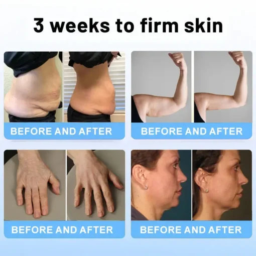 ODALIT™ Botox Bee Venom Firming Serum Stick