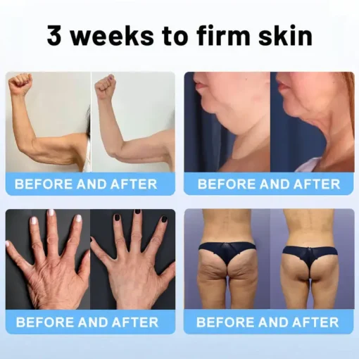 ODALIT™ Botox Bee Venom Firming Serum Stick