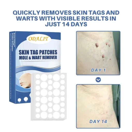 ODALIT™ Natural Skin Tag and Wart Removal Patches