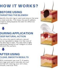 ODALIT™ Natural Skin Tag and Wart Removal Patches