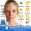 ODALIT™ OatCalm Skin Repair Cream Rx