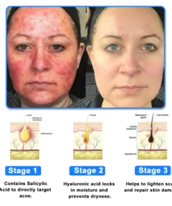 ODALIT™ OatCalm Skin Repair Cream Rx
