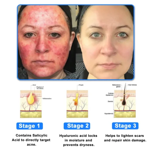ODALIT™ OatCalm Skin Repair Cream Rx