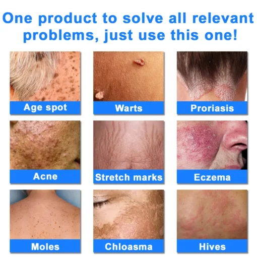 ODALIT™ OatCalm Skin Repair Cream Rx