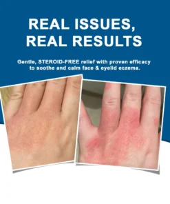 ODALIT™ OatCalm Skin Repair Cream Rx