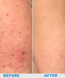 ODALIT™ OatCalm Skin Repair Cream Rx