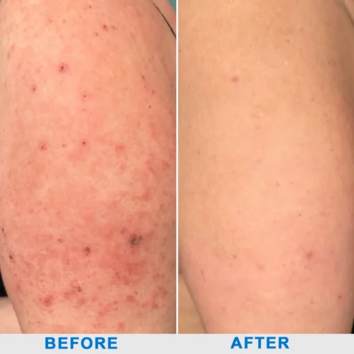 ODALIT™ OatCalm Skin Repair Cream Rx