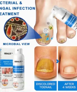 ODALIT®Magnesium Herbal Psoriasis Spray