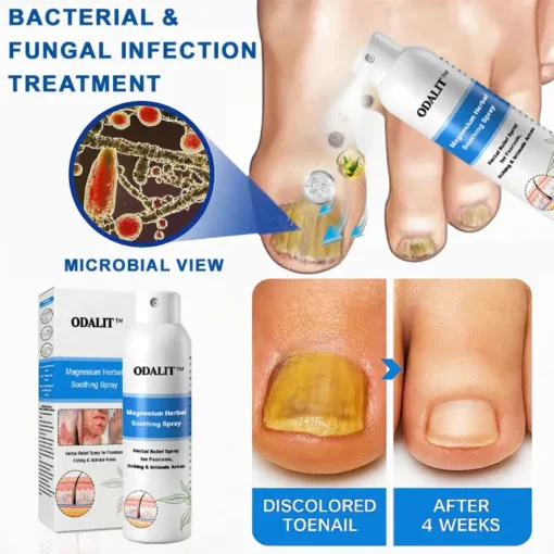 ODALIT®Magnesium Herbal Psoriasis Spray
