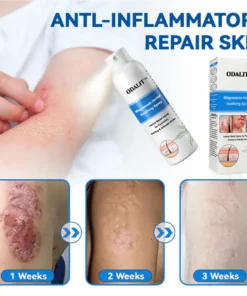 ODALIT®Magnesium Herbal Psoriasis Spray