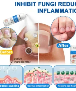 ODALIT®Magnesium Herbal Psoriasis Spray