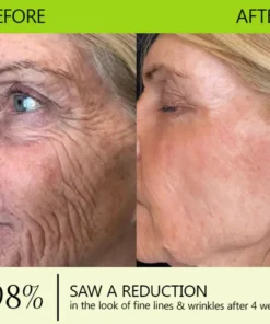 ODALIT™ Botox Retinol Shot - Eraser for Deep Wrinkles, Sagging Jowls Puffy Eyes