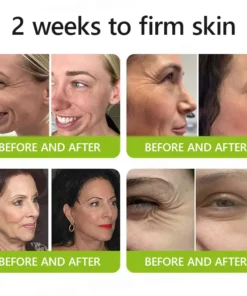 ODALIT™ Botox Retinol Shot - Eraser for Deep Wrinkles, Sagging Jowls Puffy Eyes