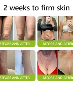 ODALIT™ Botox Retinol Shot - Eraser for Deep Wrinkles, Sagging Jowls Puffy Eyes